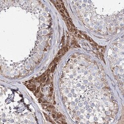 C5orf36 Antibody, Novus Biologicals 0.1mL; Unlabeled:Antibodies, Polyclonal